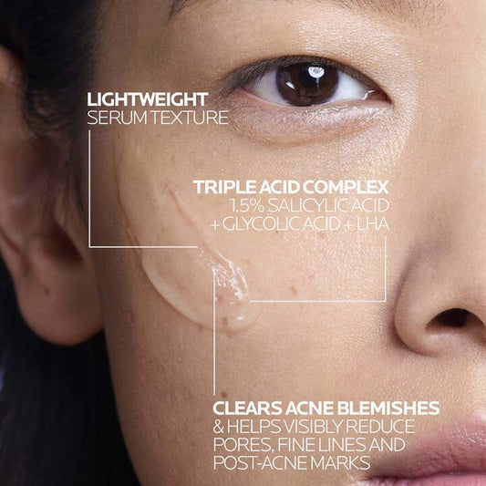 a young woman  having serum on her cheeks,highlighting smooth,glowing skin,representing daily skin care and self care routine