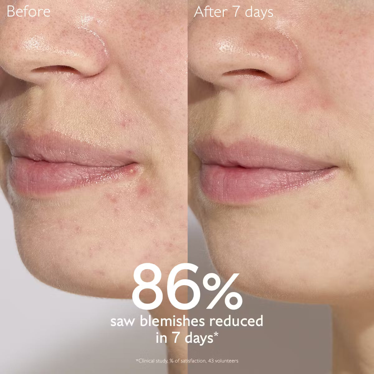 Caudalie Vinopure Blemish Control Salicylic Serum  30ml