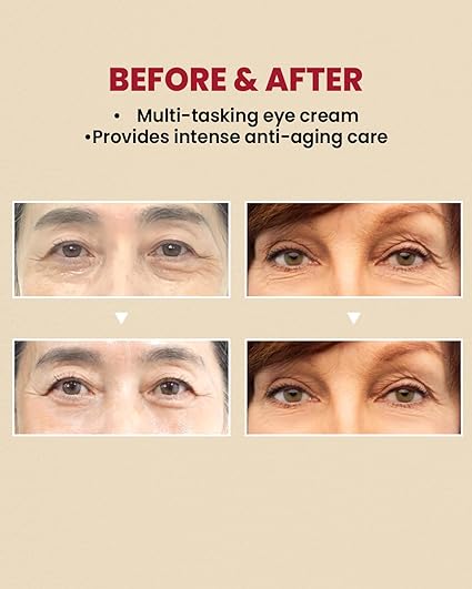 Before and after image showing reduced wrinkles and improved skin around eyes with SEOUL 1988 Retinal Liposome Eye Cream.