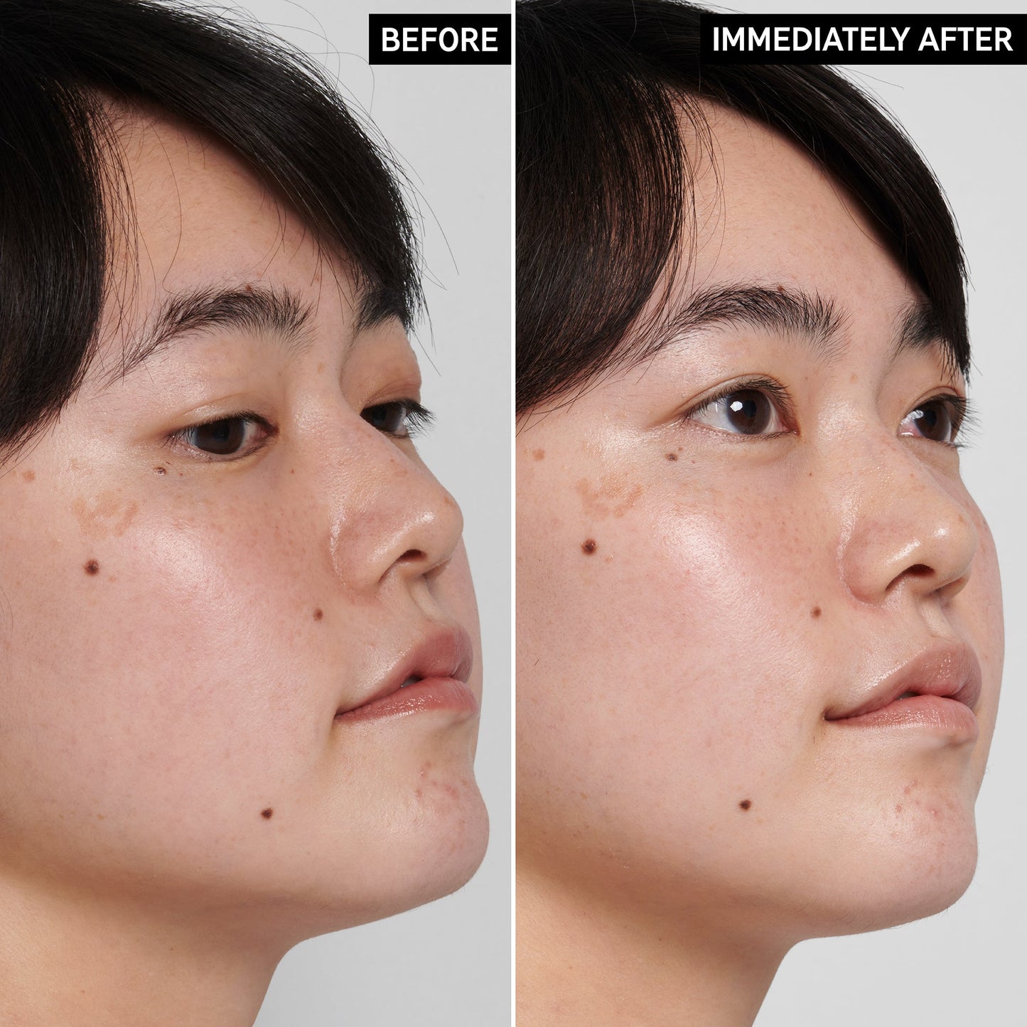 Hyaluronic Acid Cleanser - Khayest