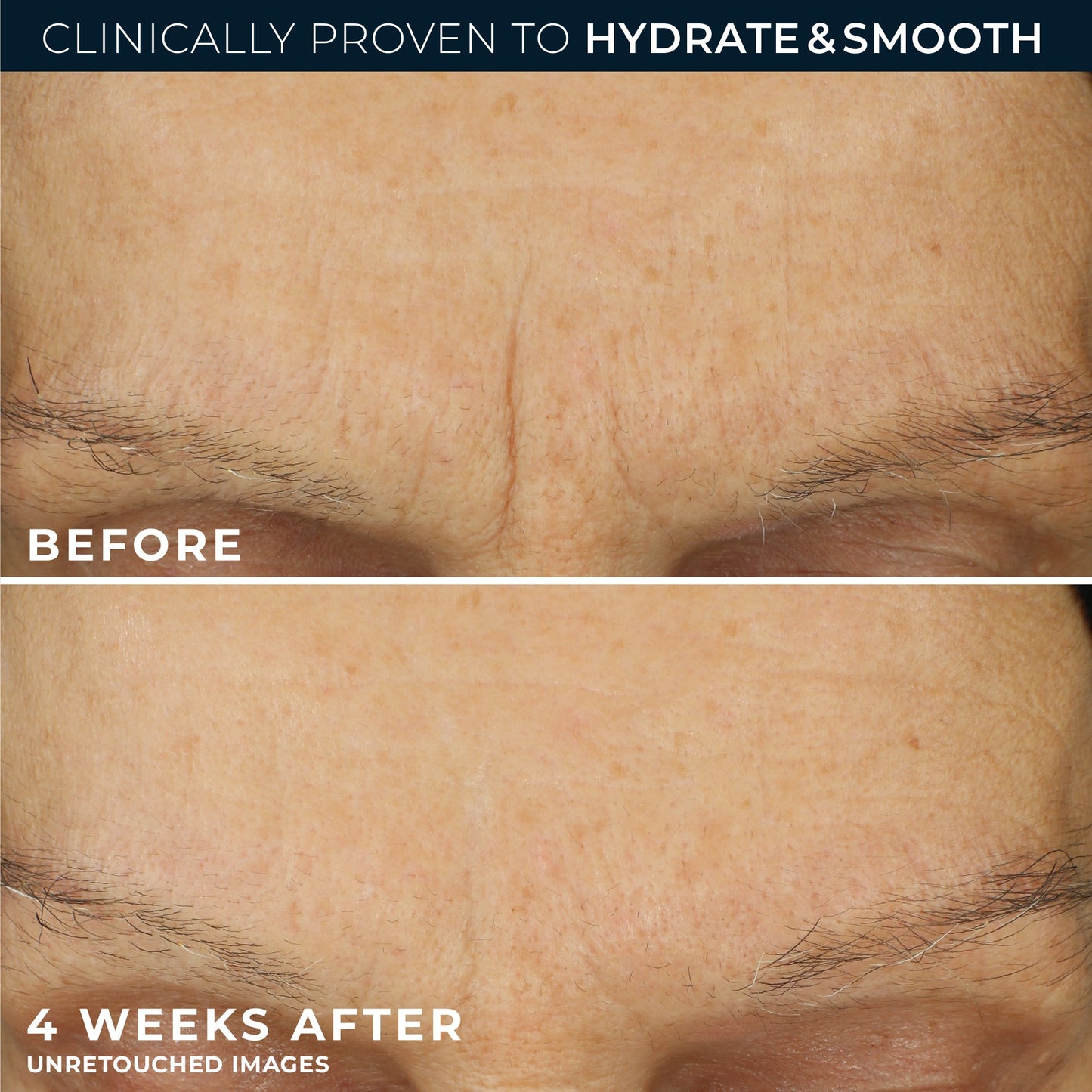 RETINOL CORREXION® Line Smoothing Max Hydration Cream - Khayest