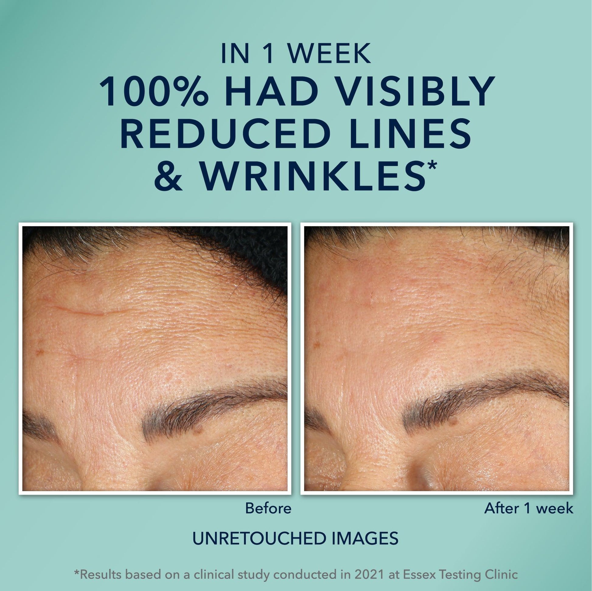 MULTI CORREXION® Hydrate + Plump Serum Capsules - Khayest