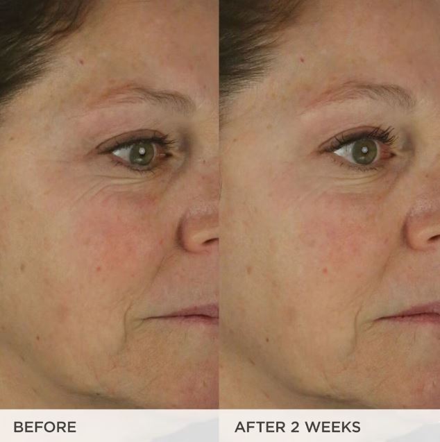 TATCHA The Dewy Skin Cream Face Moisturizer 50ml - Khayest