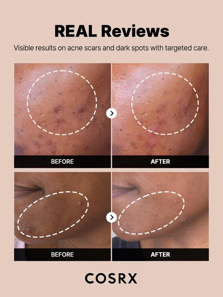 COSRX The Alpha Arbutin 2 Discoloration Care Face Serum 50ml - Khayest