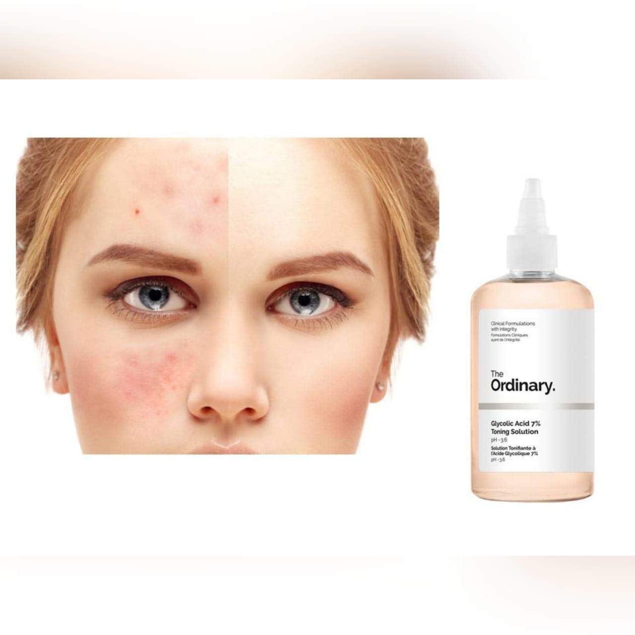 The Ordinary Glycolic Acid 7% Toning Solution Face Toner 240ml - Khayest
