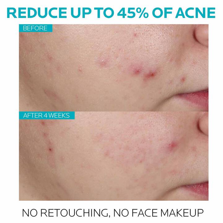 La Roche Posay Effaclar Salicylic Acid Acne Treatment Face Serum 30ml - Khayest