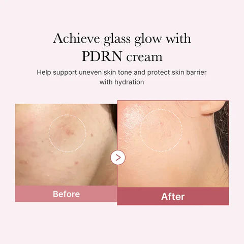 Medicube PDRN Pink Hyaluronic Moisturizing Cream 50ml - Khayest