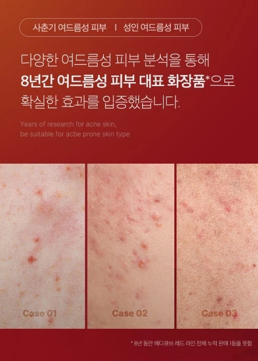 Medicube Red Cream 50ml Moisturizing Cream - Khayest