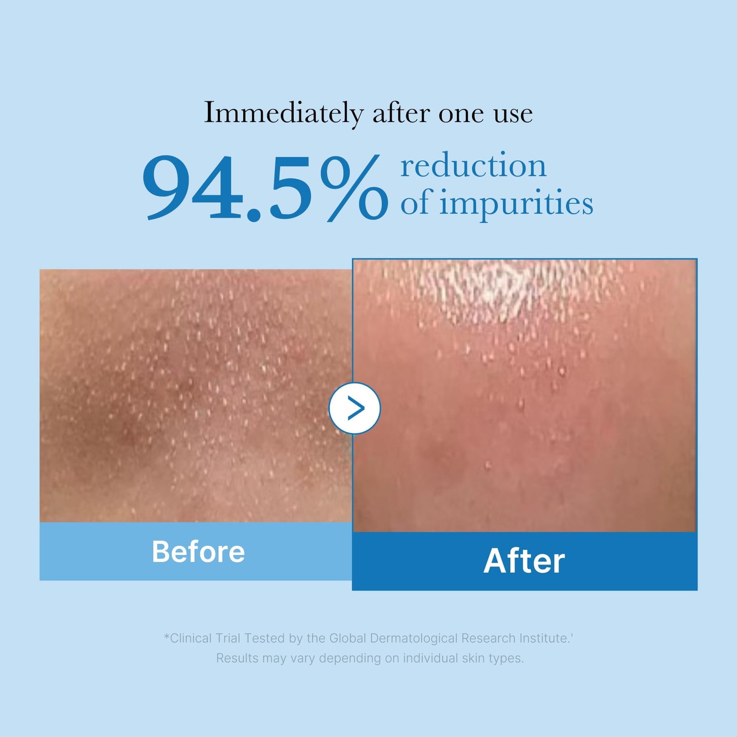 Medicube Zero Pore Blackhead Deep Cleansing Oil 205ml - Khayest