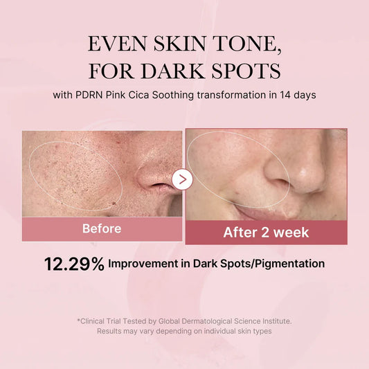 Medicube PDRN Pink Cica Soothing Toner 250ml - Khayest