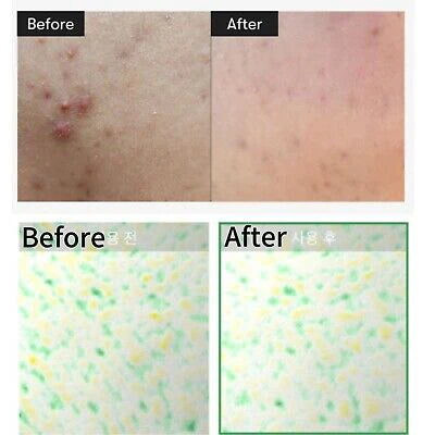 VT Cica Reedle Shot 100 Face Serum 50ml - Khayest