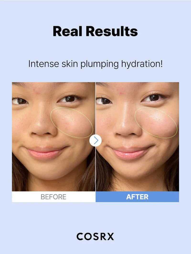 COSRX The Hyaluronic Acid 3 Serum 20ml - Khayest