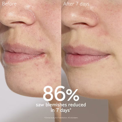 Caudalie Vinopure Blemish Control Salicylic Serum  30ml