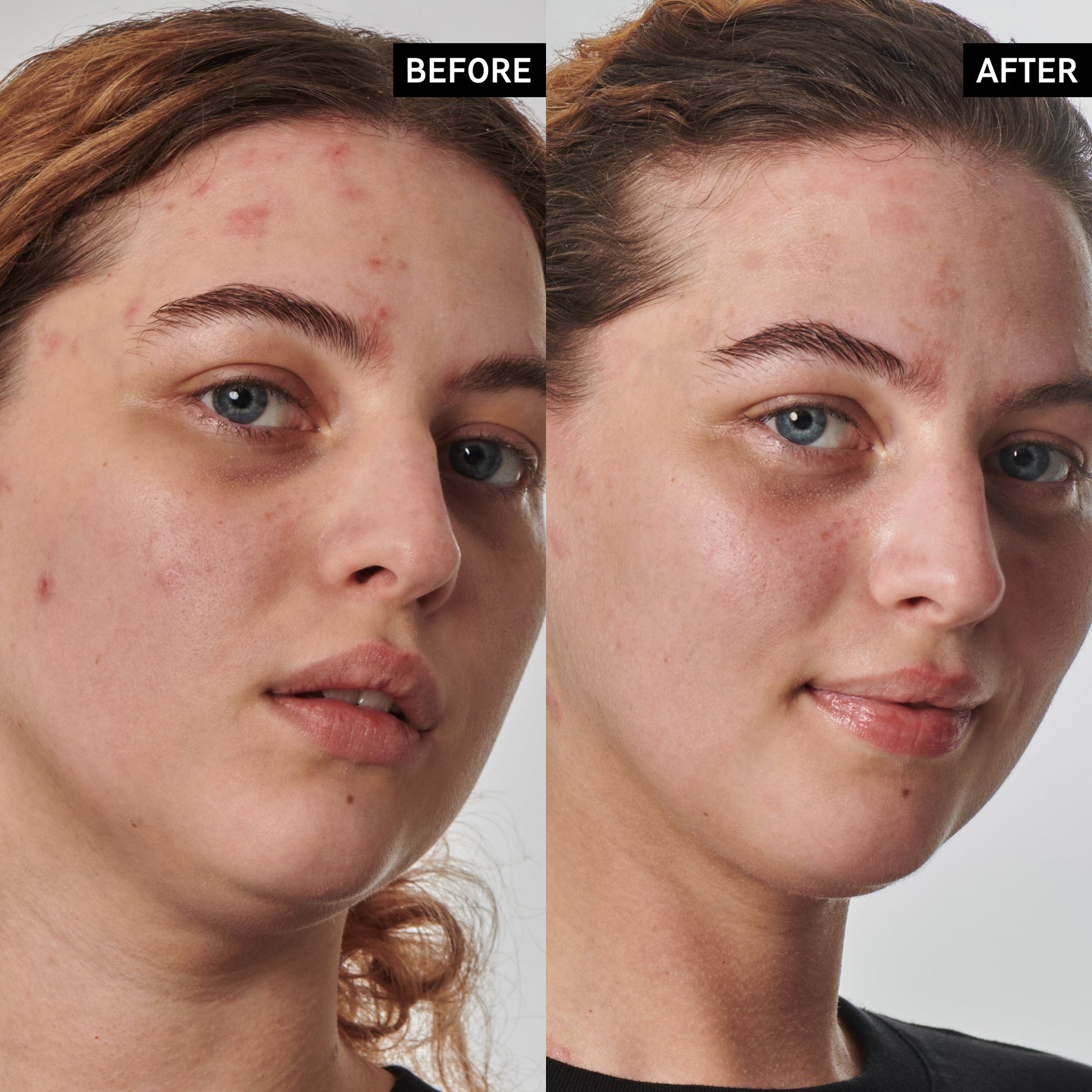 Dry and Rough Skin Solution - Khayest