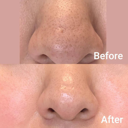 Medicube Zero Pore Pad 2.0 155g - Khayest