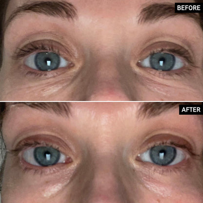 Brighten-i Eye Cream - Khayest