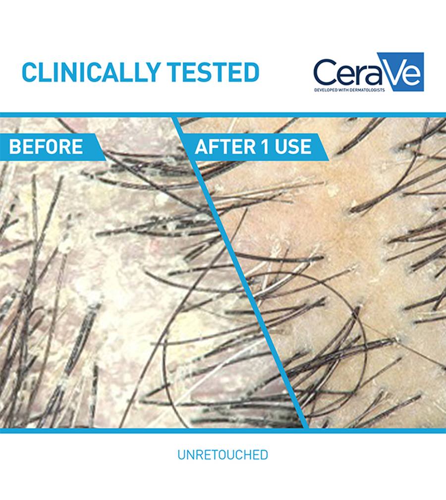 cerave anti Dandruff Hydrating Hair conditioner 266Ml - Khayest