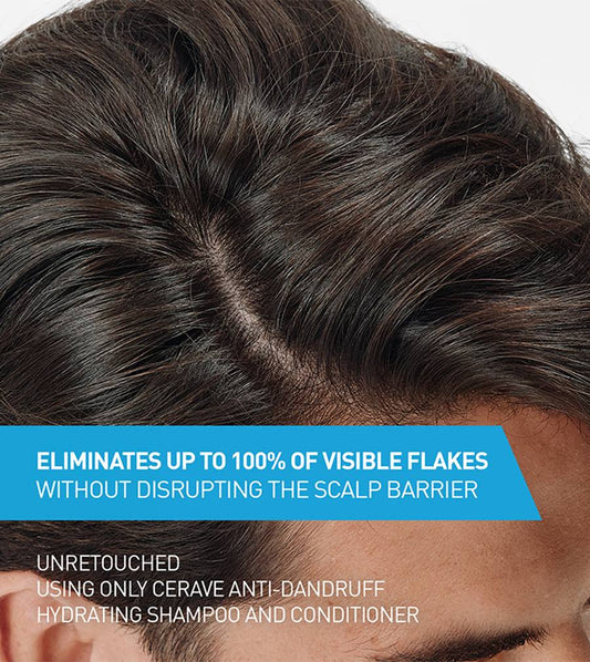 cerave anti Dandruff Hydrating Hair conditioner 266Ml - Khayest