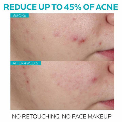 La Roche Posay Effaclar Salicylic Acid Acne Treatment Face Serum 30ml - Khayest