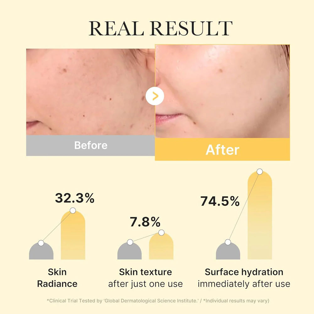 Medicube Kojic Acid Turmeric Brightening Gel Mask - Khayest