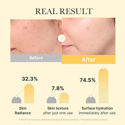 Medicube Kojic Acid Turmeric Brightening Gel Mask - Khayest